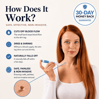 Vamiyo™ Skintag Removal Kit